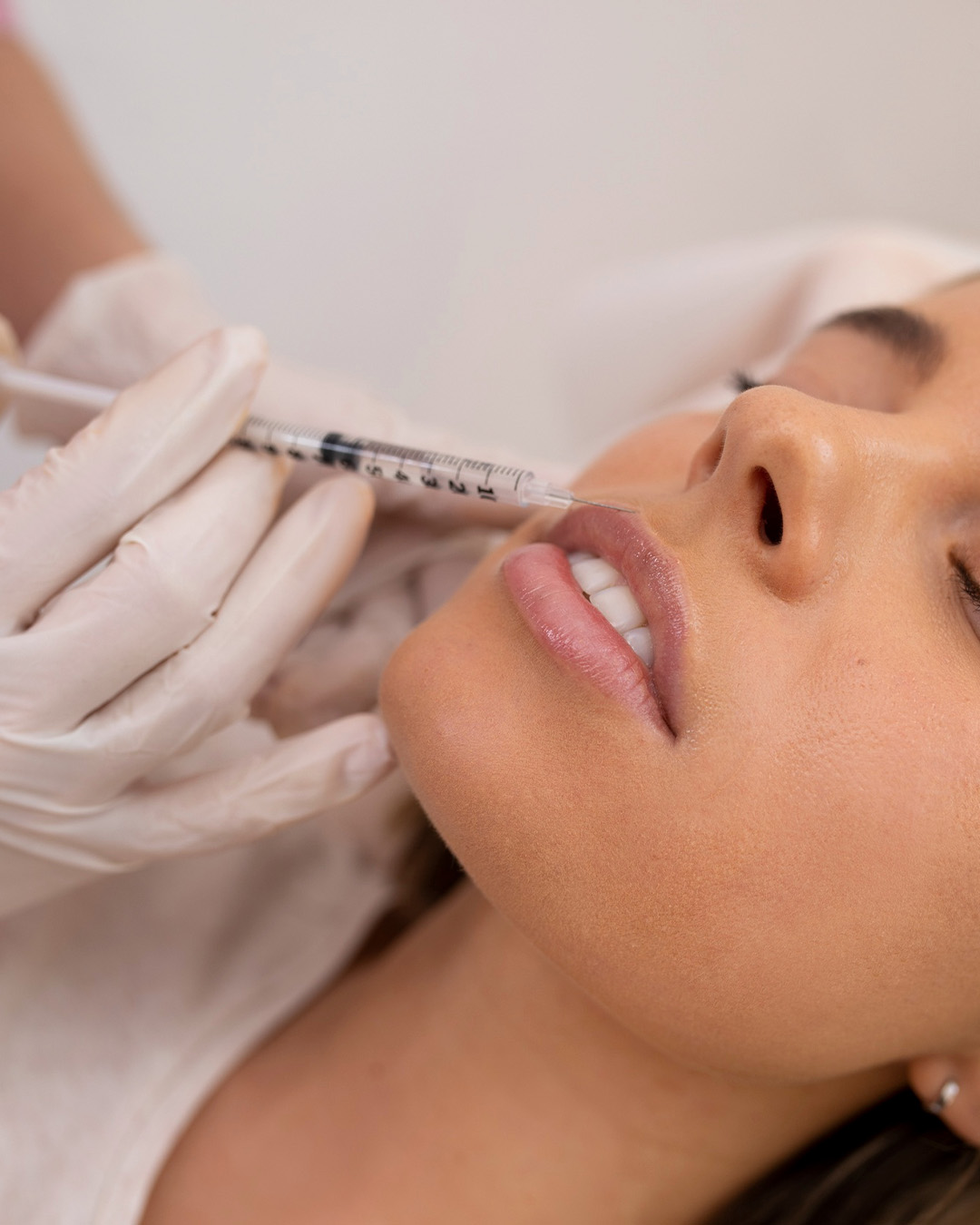 IMERSÃO EM PREENCHIMENTO LABIAL: DO PLANEJAMENTO À APLICAÇÃO, COM DEMONSTRAÇÃO AO VIVO